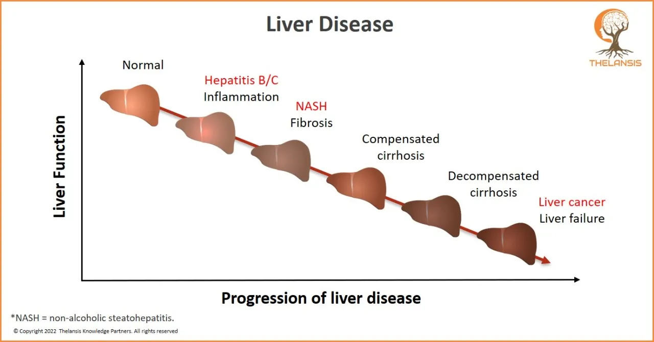 Progression of Liver Disease - THELANSIS