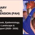 Press Release on Pulmonary Arterial Hypertension (PAH)
