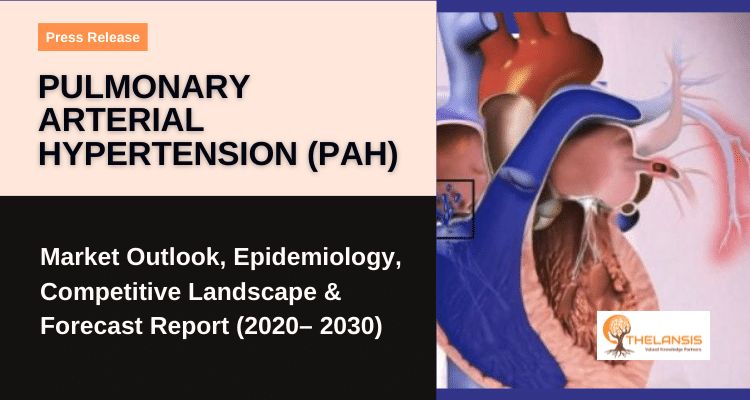 Press Release on Pulmonary Arterial Hypertension (PAH)