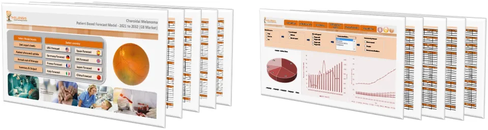 Choroidal Melanoma Market Forecast