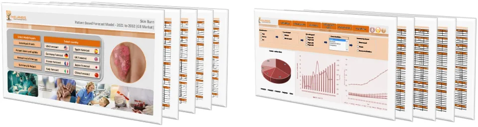 Skin Burn Market Forecast