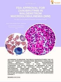 FDA Approval for Zanubrutinib in Waldenstrom macroglobulinemia (WM)
