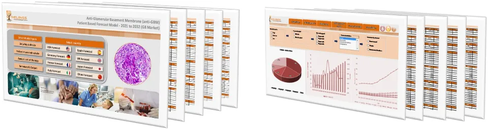 anti-Glomerular Basement Membrane (anti-GBM) Market Forecast