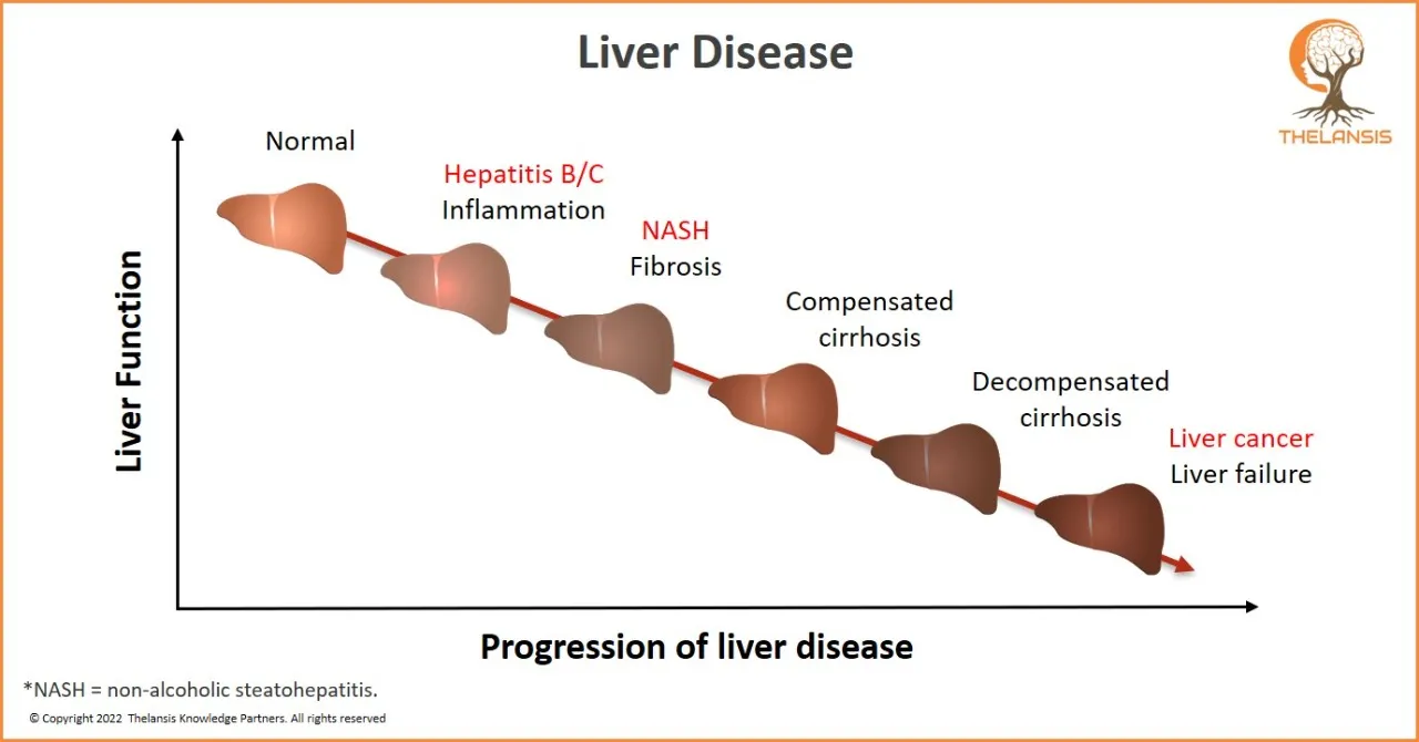 Progression of Liver Disease