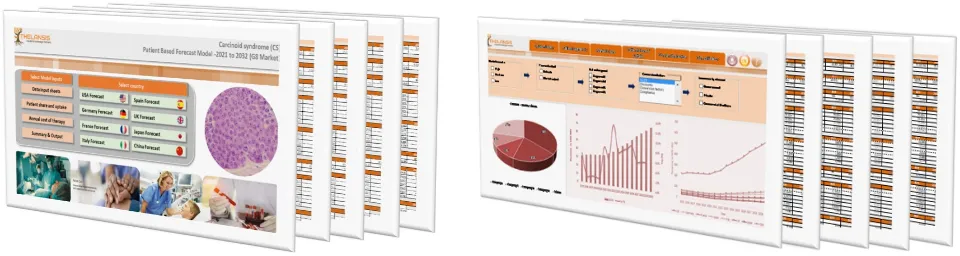 Carcinoid syndrome (CS) Market Forecast