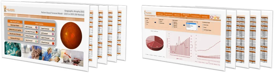 Geographic Atrophy (GA) Market Forecast