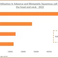 USA: PD 1 Utilization in Advance and Metastatic Squamous Cell Carcinoma of the Head and Neck - 2022