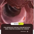 FDA Approves TUKYSA® for Metastatic HER2-Positive Colorectal Cancer