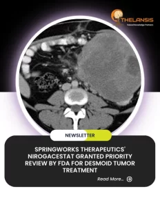 SpringWorks Therapeutics' Nirogacestat Granted Priority Review by FDA for Desmoid Tumor Treatment