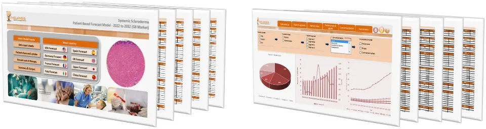 Systemic Scleroderma Market Forecast