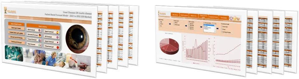 Uveal Diseases Market Forecast
