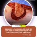 Abbisko Cayman's ABSK012 Granted FDA Orphan Drug Designation for Soft Tissue Sarcoma Treatment
