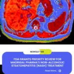 FDA Grants Priority Review for Madrigal Pharma's Non-Alcoholic Steatohepatitis (NASH) Treatment