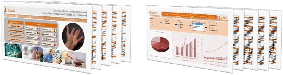 Dupuytren's Disease (Palmar Fibromatosis) Market Forecast
