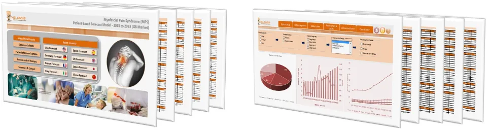 Myofascial Pain Syndrome (MPS) Market Forecast