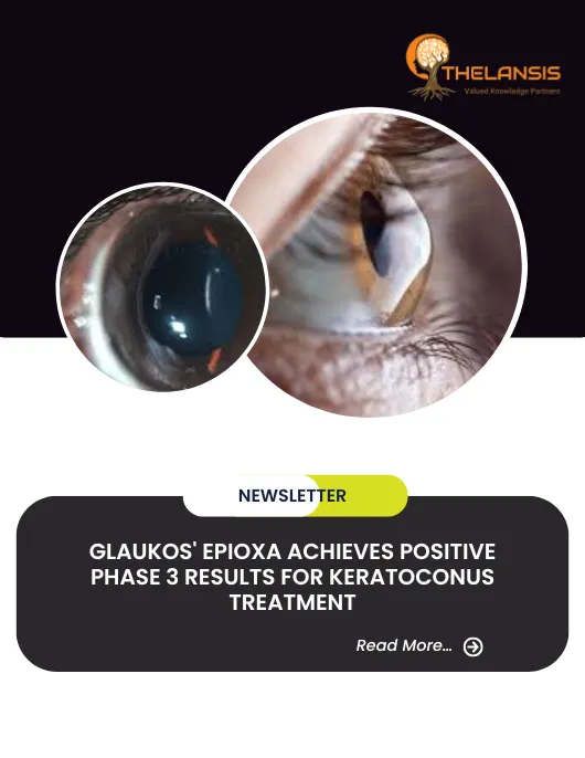 Glaukos' Epioxa Achieves Positive Phase 3 Results for Keratoconus Treatment