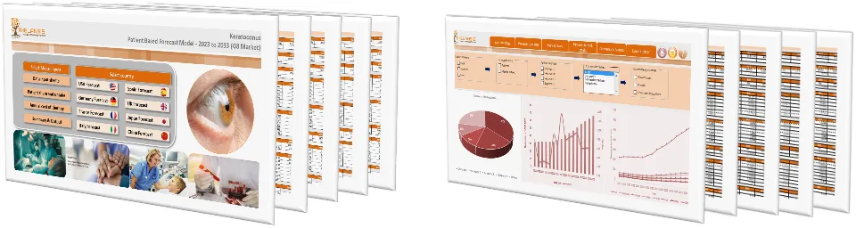 Keratoconus Market Forecast