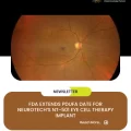 FDA Extends PDUFA Date for Neurotech’s NT-501 Eye Cell Therapy Implant